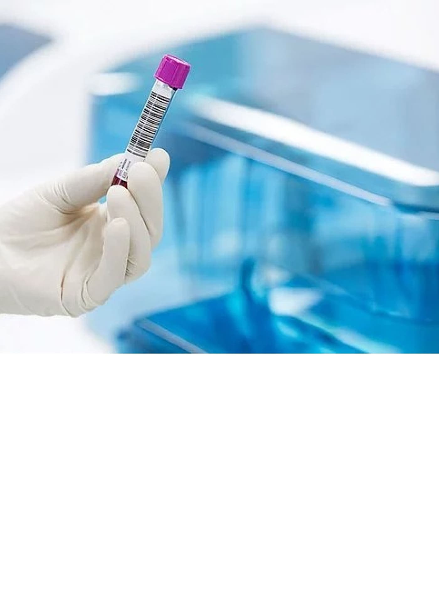 VACUETTE® vs китайские аналоги: что должен включать входной контроль